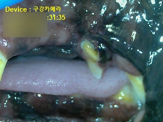 강아지 스케일링 중 발견된 어금니 깨짐! 치료법은?