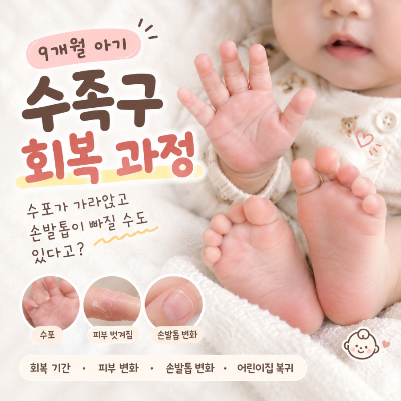 [육아정보] 9개월 아기 수족구 회복 과정 수포가 가라앉은 후 피부 벗겨짐과 손발톱 변화까지