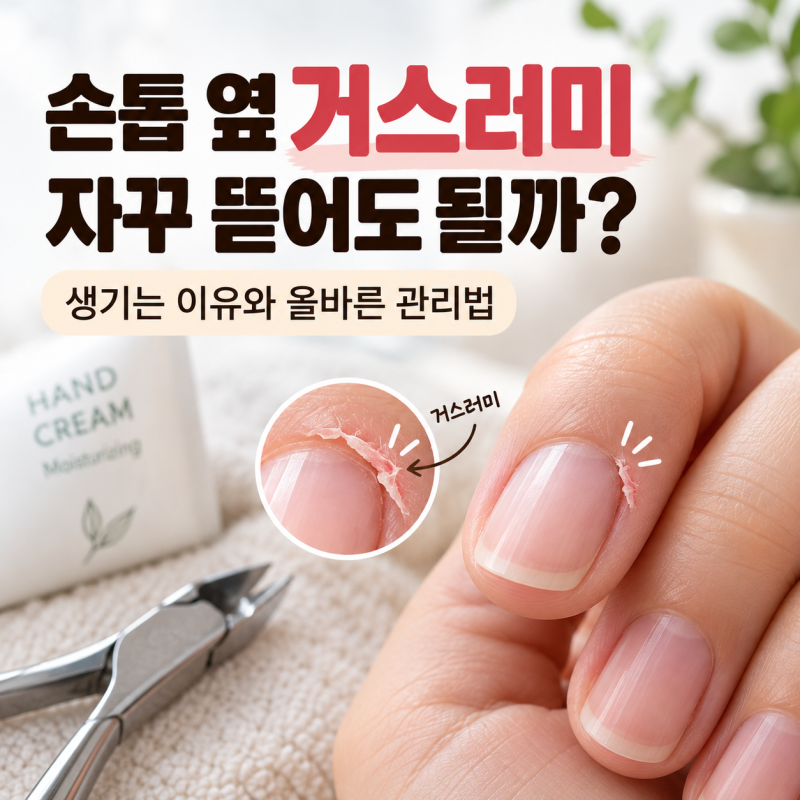 손톱 옆 거스러미 자꾸 뜯어도 될까? 생기는 이유와 올바른 관리법