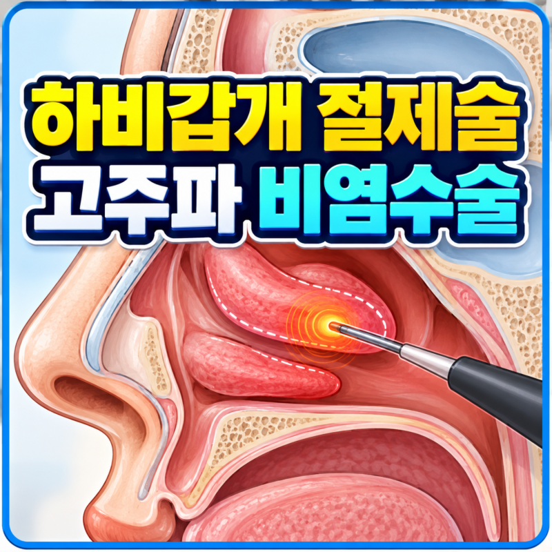 하비갑개 절제술과 고주파 비염 수술 차이, 비중격 교정술 실비와 질병수술비 청구