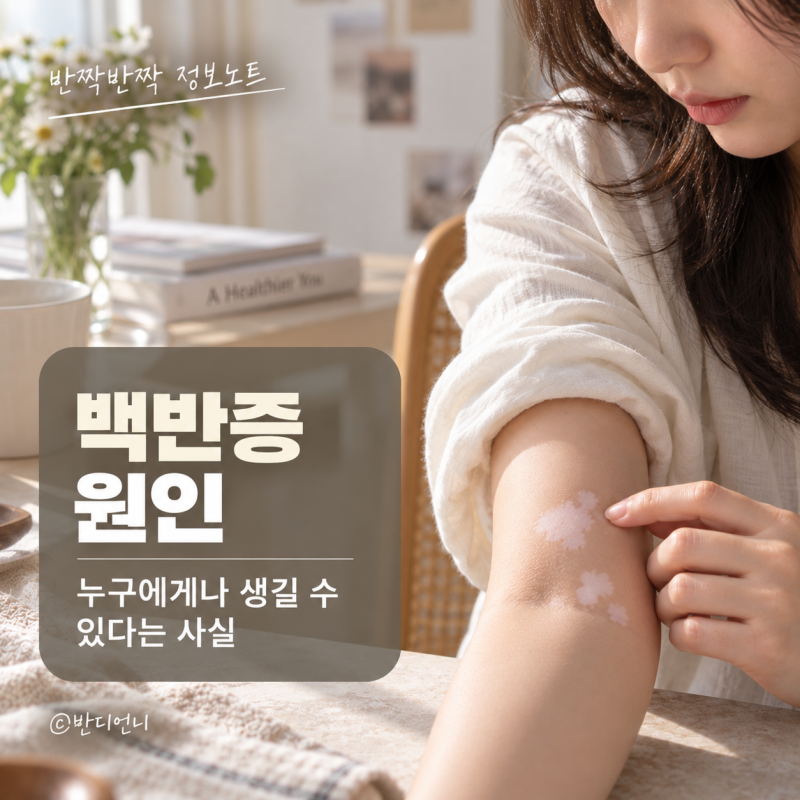 백반증원인, 누구에게나 생길 수 있다는 사실
