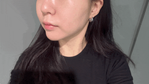 송도 고우리스킨부스터 효과 고우리스킨부스터 일주일 얼굴 탄력 변화 후기
