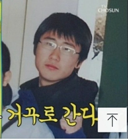 입에 개구기까지 끼었다…지금은 유명해진 두 트로트 스타의 무명시절