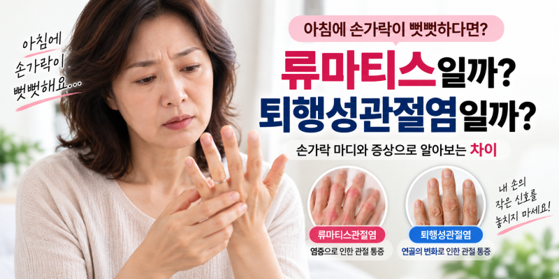 아침에 손가락이 뻣뻣하면 류머티즘일까?|퇴행성관절염과 어떻게 다를까