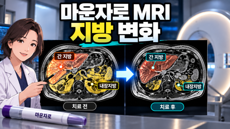 마운자로 1년 투여 후 MRI 결과: 간 지방과 내장지방 변화 수치