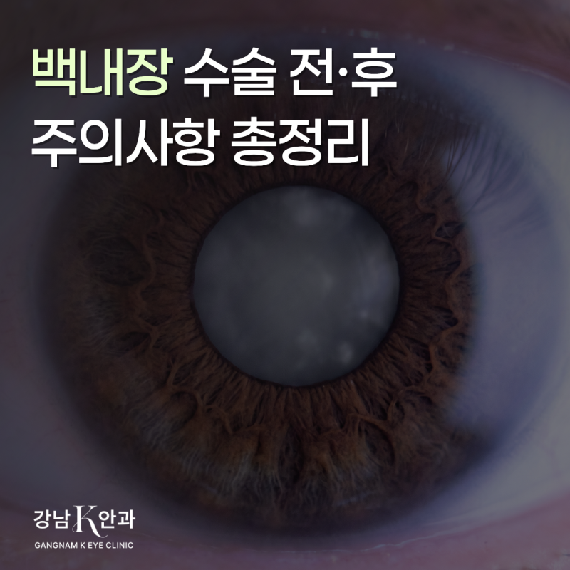 강남 백내장 수술 전·후 주의사항 총정리