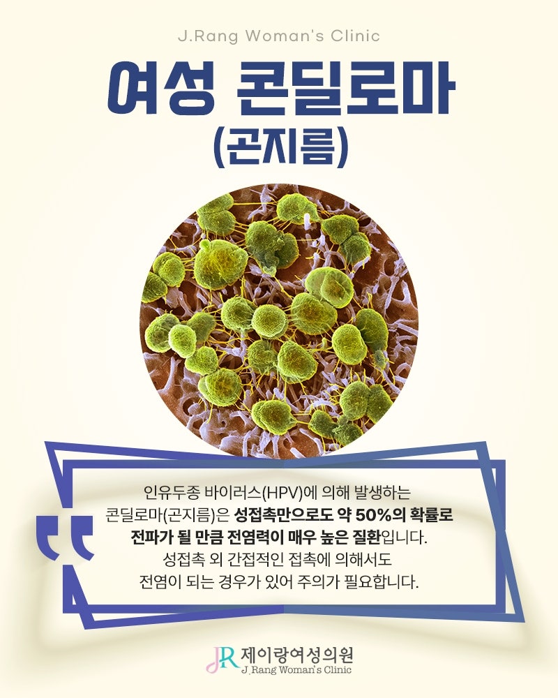 신길동산부인과 콘딜로마 원인 및 증상 치료방법은?