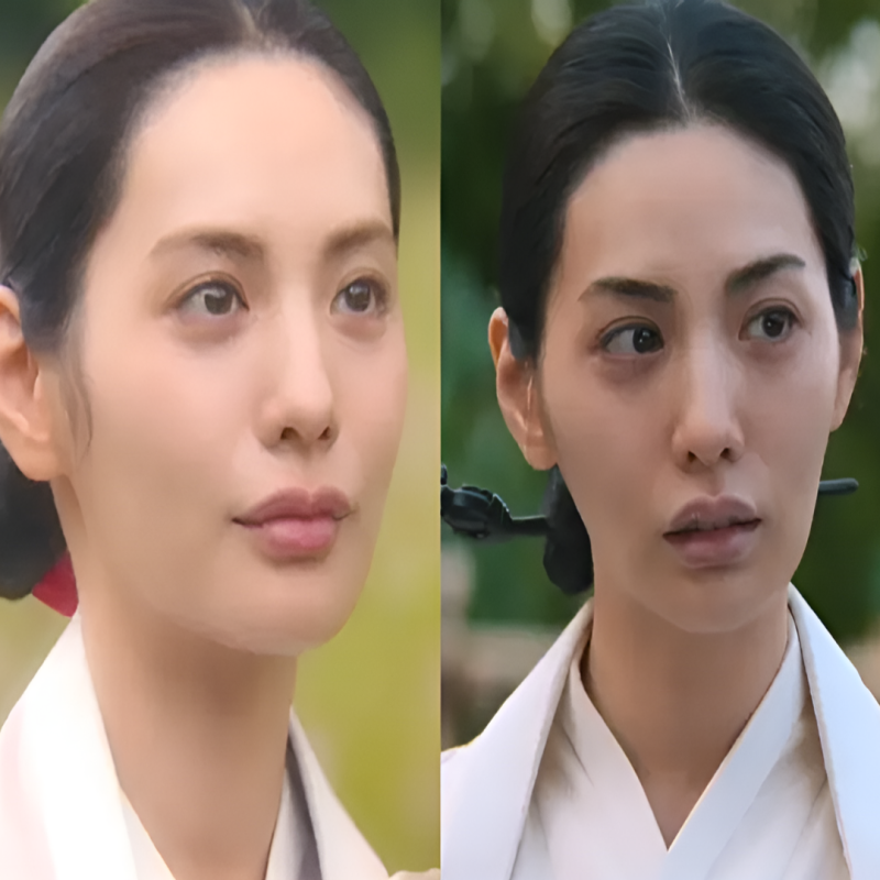 예전과 달라진 나나 입술필러, 이번 스캔들 사극에서 유독 눈에 띄는 이유