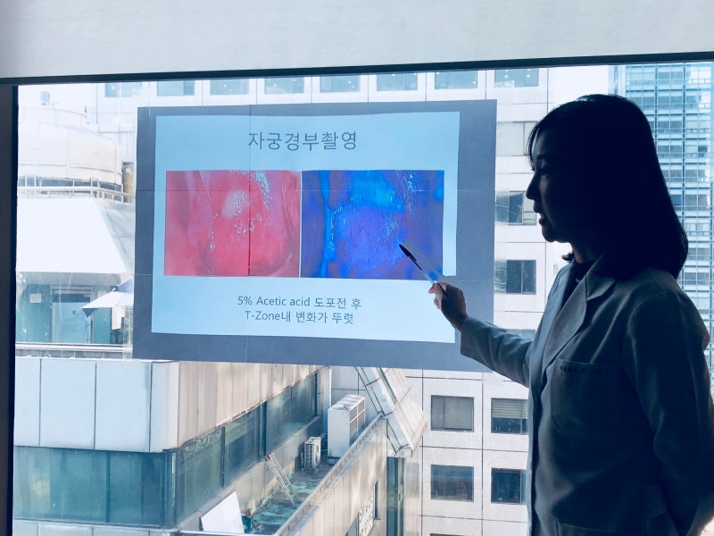 자궁경부이형성증 CIN1에서 CIN2로 진행되는 증상, 원인, 검사 주기, 치료 시기
