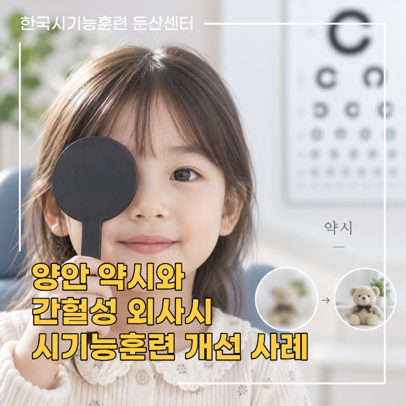 [사시와 약시 교정] 양안약시와 간헐성외사시가 같이 있던 아이 - 시기능훈련 개선 사례