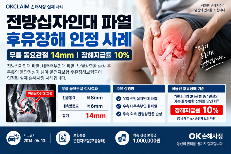 전방십자인대 파열 후유장해｜무릎이 흔들린다면 동요관절 확인해야 합니다