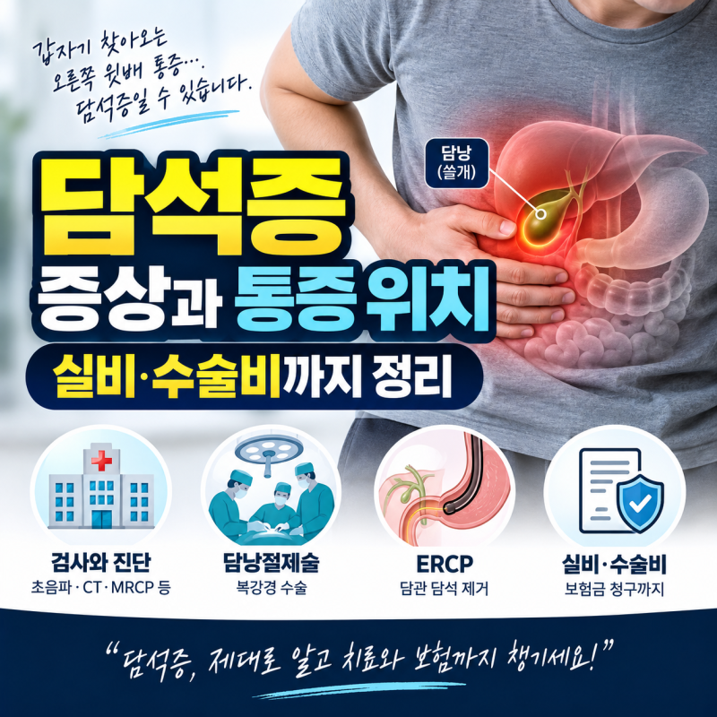 담석증 증상과 통증 위치｜담낭절제술 수술 기준부터 실비·수술비까지