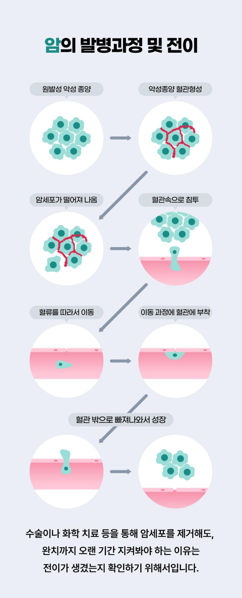암 진단 받았는데 ‘전이암’이라고 합니다… 원발암이 아니면 보험금이 달라집니다