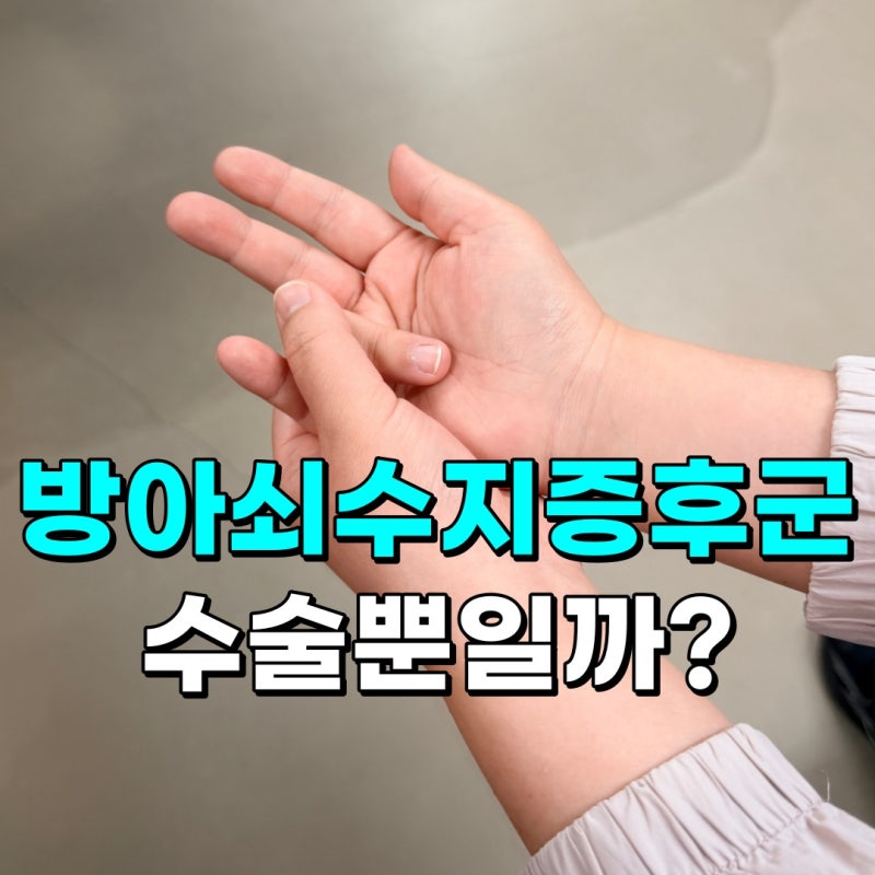 방아쇠수지증후군 치료 손가락 딸깍 소리와 뻣뻣함이 반복된다면?