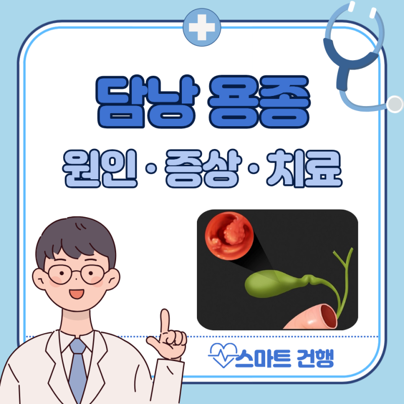 담낭 용종 원인, 증상, 제거 수술 비용 : 크기, 음식