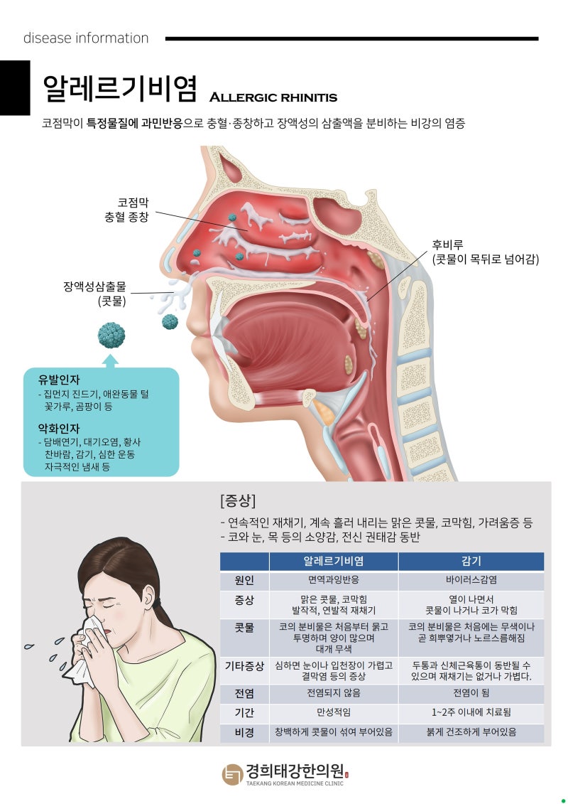 알레르기 비염, 완치할 수 있을까요? 항히스타민제·비강스테로이드·면역치료 효과와 부작....