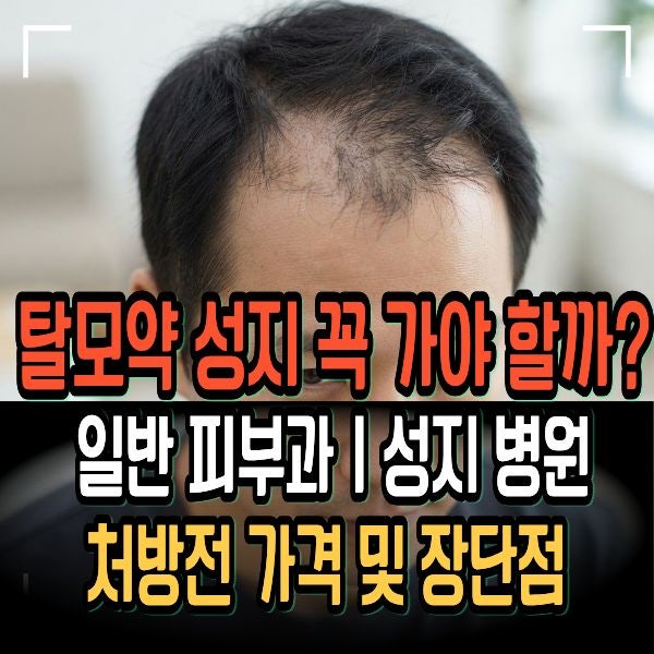 탈모약 성지 꼭 가야 할까? 일반 피부과ㅣ성지 병원 처방전 가격 및 장단점