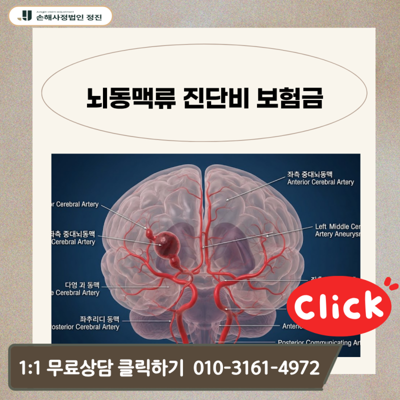 뇌동맥류 진단비 보험금, I67.1 코드 받고도 전액 거절당했다면 어떻게 해야 할까?