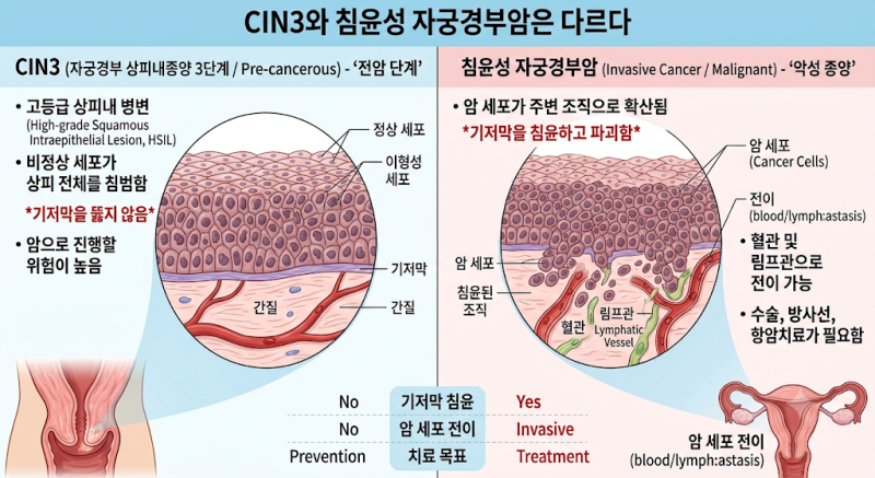 자궁경부이형성증 CIN3, 진단서가 N87.2라면 제자리암(D06) 보험금을 받을 수 있을까?