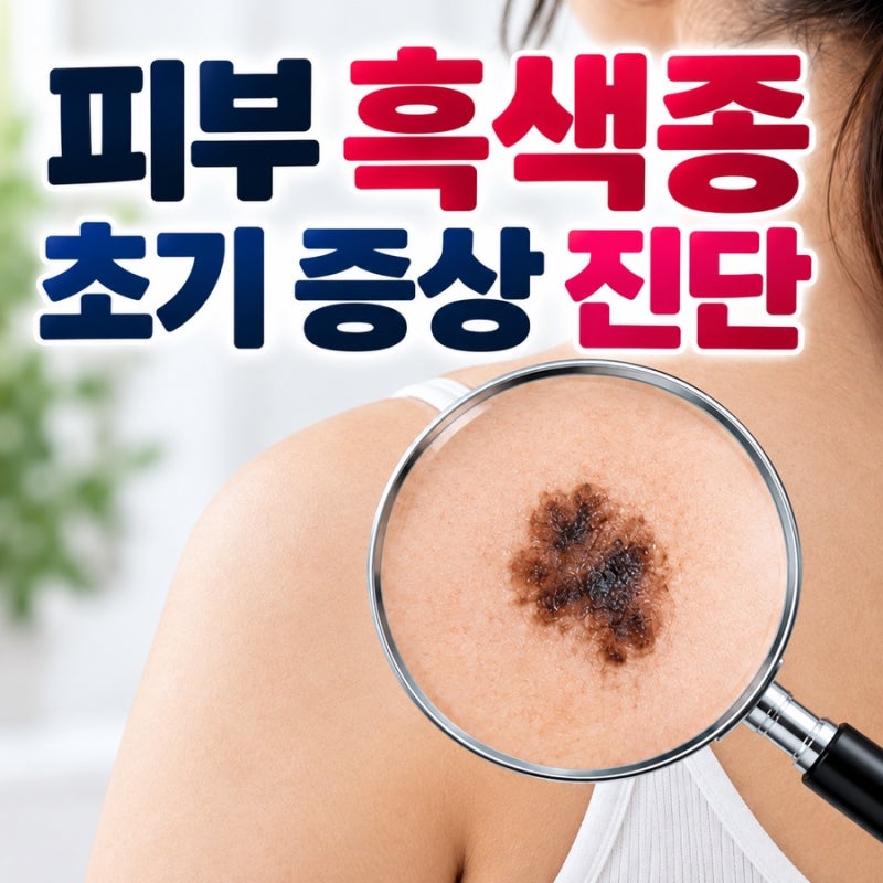피부 흑색종 초기 증상 진단 점이 갑자기 달라졌나요?