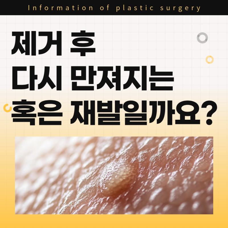 대구지방종병원, 제거 후 다시 만져지는 혹은 지방종 재발일까요?