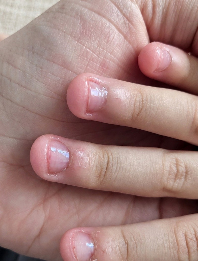 손톱뜯기방지 대체 행동 알려주기｜예비 초등 딸 현실 기록