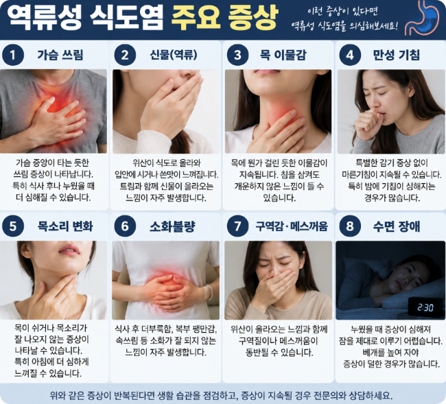 역류성 식도염 증상｜가슴쓰림·신물·목 이물감이 반복된다면