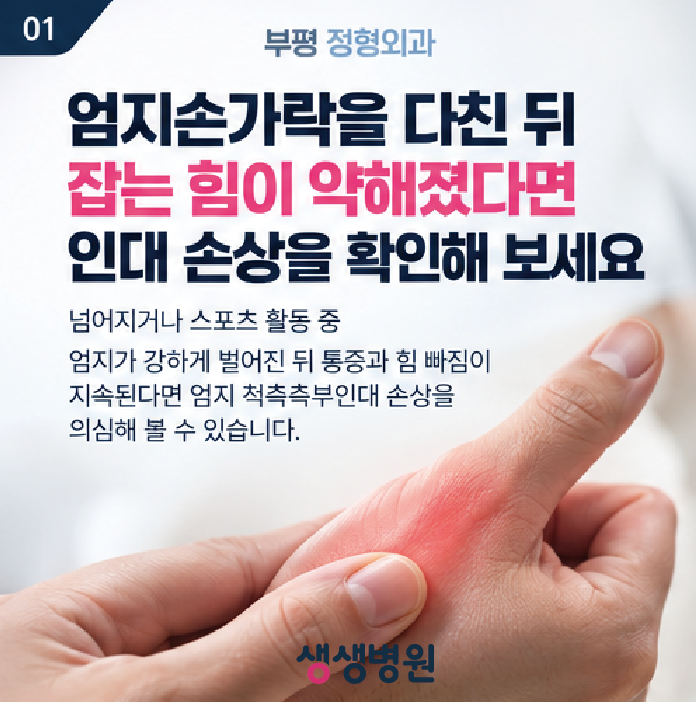 부평 정형외과 | 엄지손가락을 다친 뒤 잡는 힘이 약해졌다면 인대 손상을 확인해 보 세요 부....