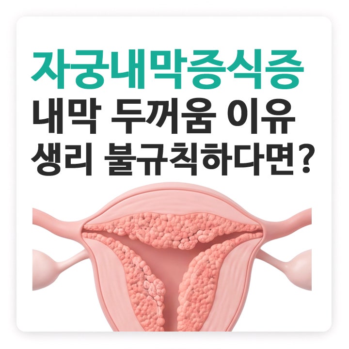 자궁내막증식증 원인, 생리 불규칙해졌다면 꼭 확인해 보세요