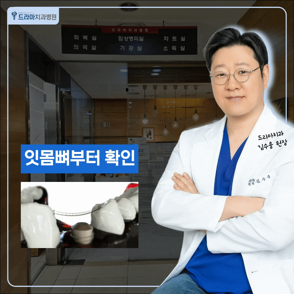 분당임플란트, 빠진 이를 오래 두면 나중에 심기 어려워질까요?