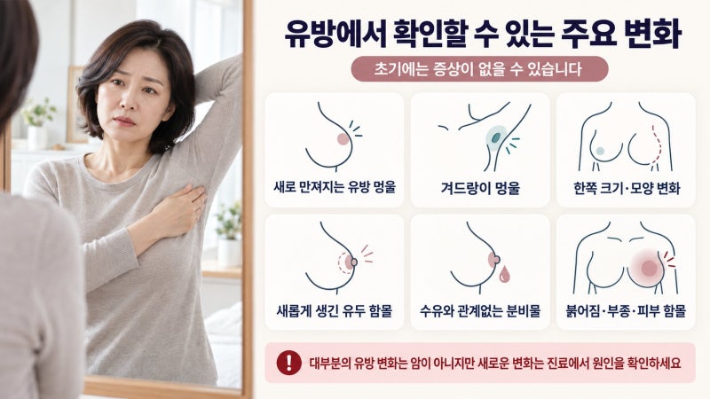 유방암 증상 총정리, 멍울부터 유두 함몰·오렌지껍질 피부까지