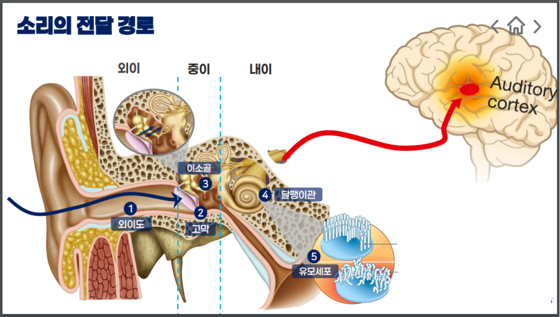 창원보청기 // 전음성 난청이란?
