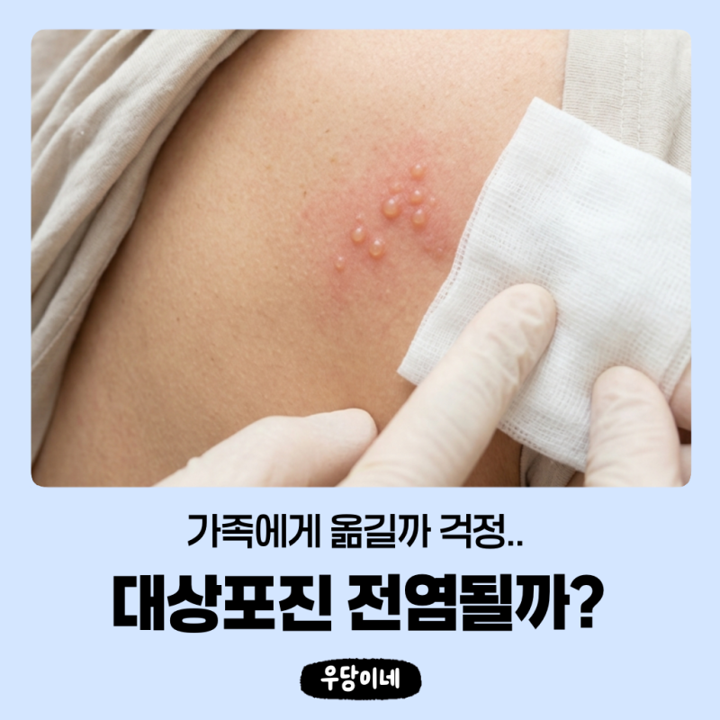 대상포진 전염될까요? 가족에게 옮길까 걱정된다면