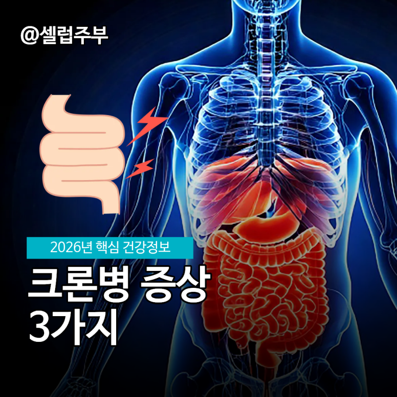 크론병 증상 의심 신호 는?
