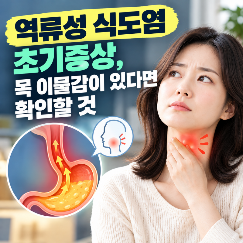 역류성 식도염 초기증상, 목 이물감이 있다면 확인할 것