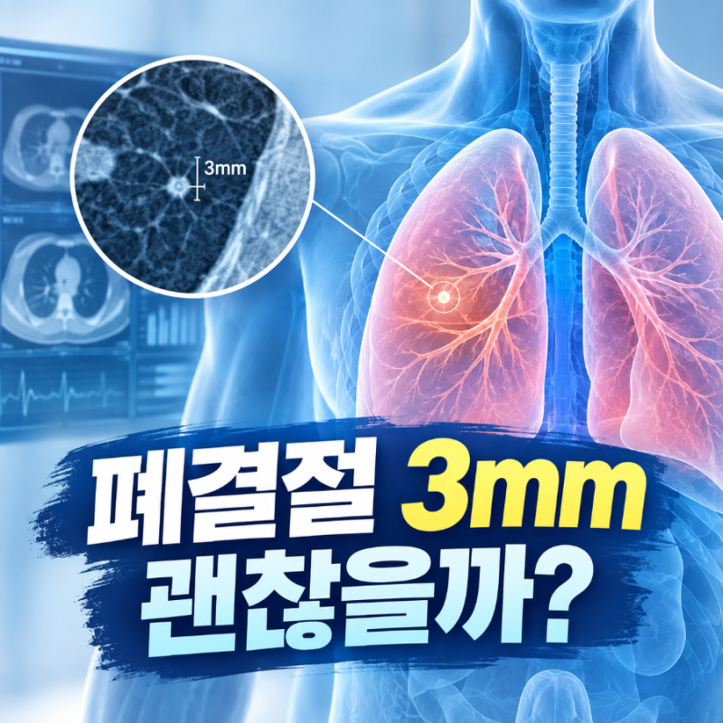 건강검진 폐결절 3mm 발견됐다면? CT 결과 제대로 읽는 법