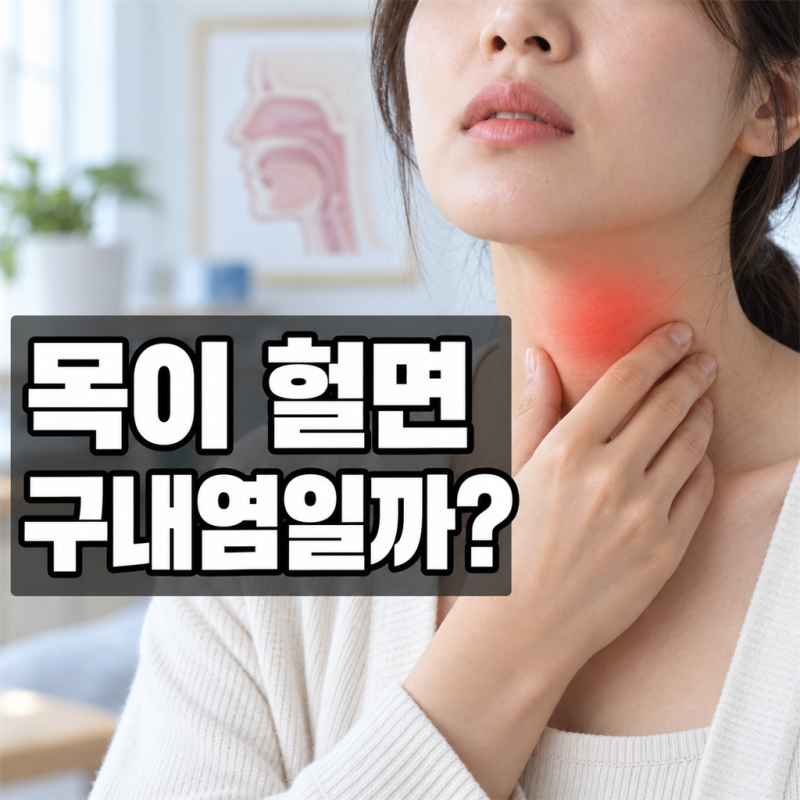 목구멍구내염, 입안 헐음과 다른 점 3가지
