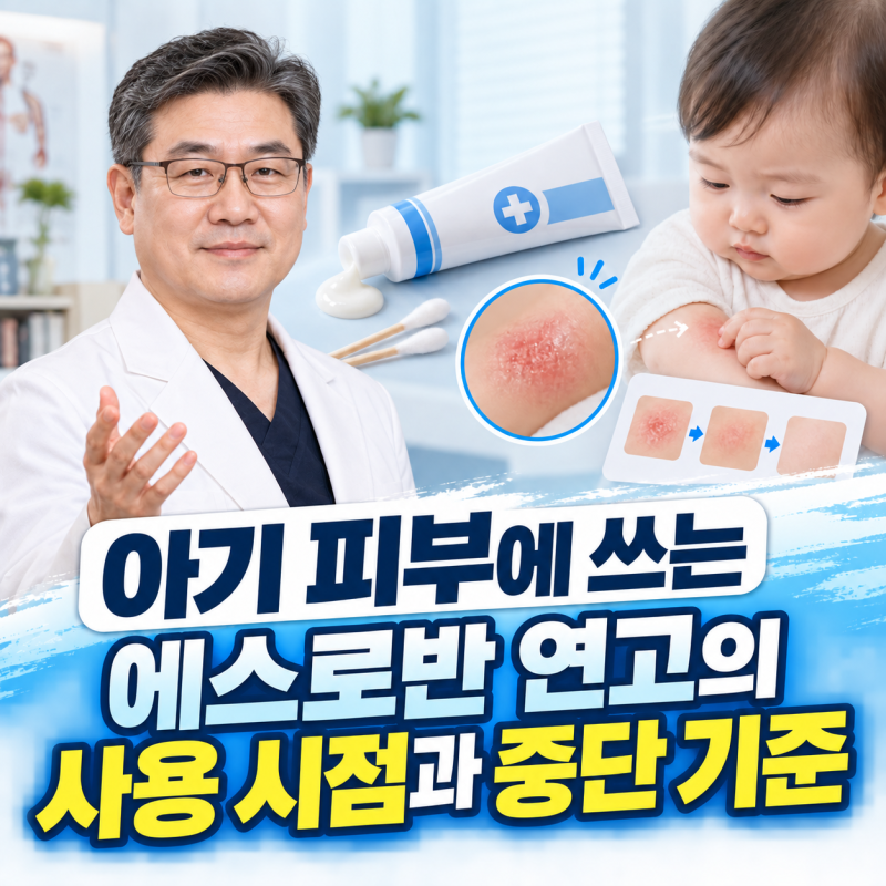 아기 피부에 쓰는 에스로반 연고의 사용 시점과 중단 기준