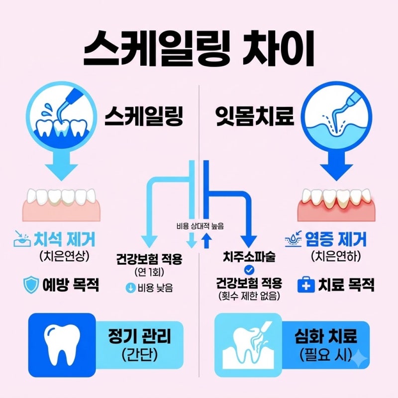 스케일링과 잇몸치료는 무엇이 다를까 건강보험 적용과 비용 차이 안내