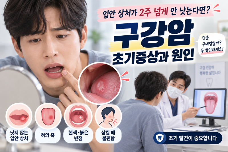 입안 상처가 2주 넘게 안 낫는다면? 구강암 초기증상과 원인