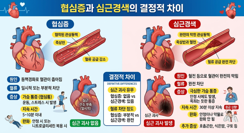 급성심근경색(I21), 심근효소가 정상이라면 불안정성 협심증(I20)일까?_오늘의 손사 서호석손....