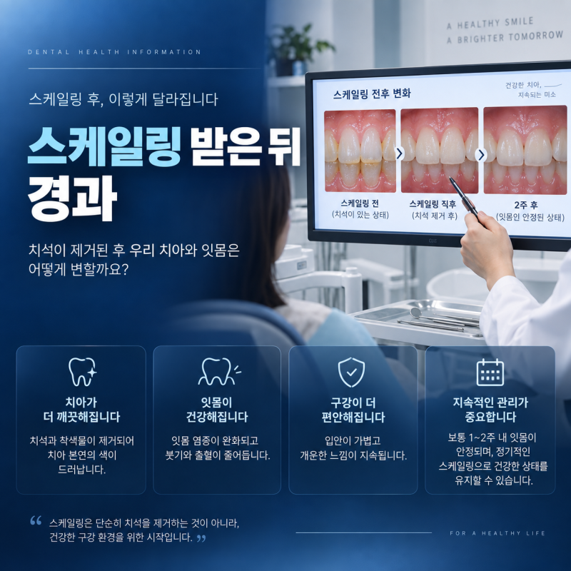 대전스케일링 받은 뒤 경과, 순서대로