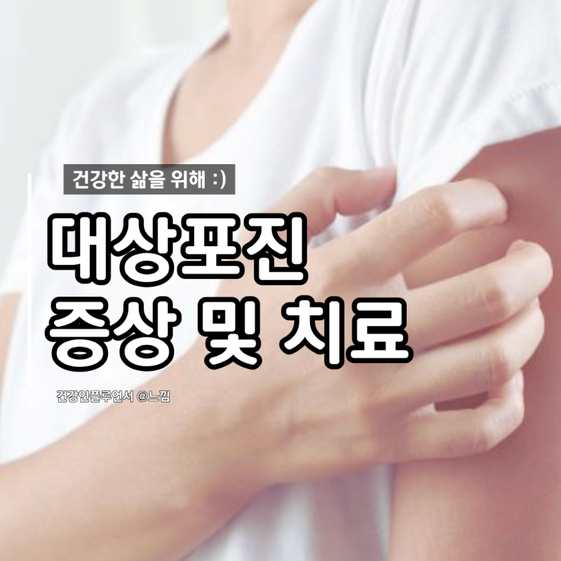 "단순 몸살인 줄 알았는데.." 대상포진 초기 증상과 골든타임 치료법