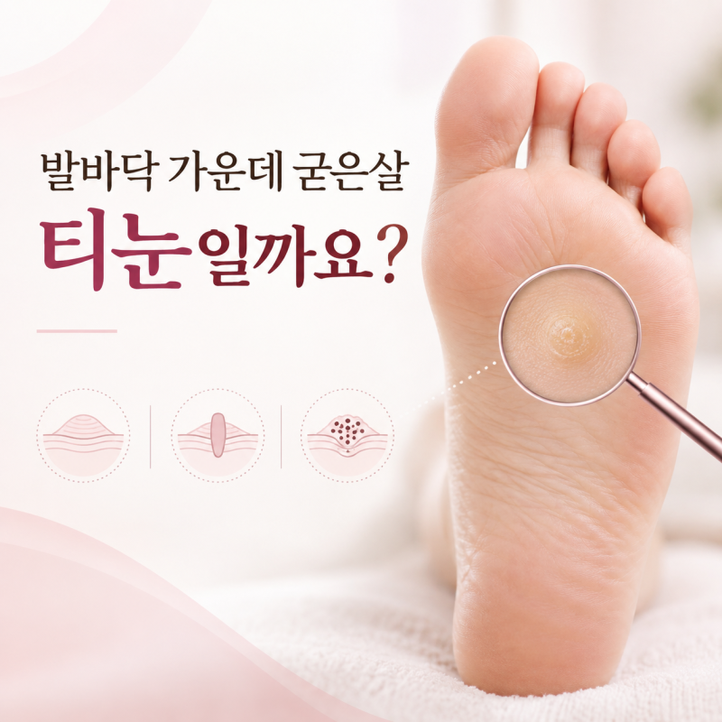 발바닥 가운데 굳은살, 티눈일까요? 눌렀을 때 아프다면 확인하세요