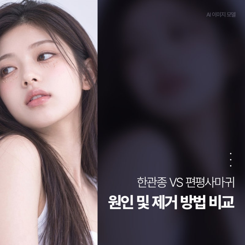 진해아그네스 한관종 VS 편평사마귀 원인 및 제거하는 법