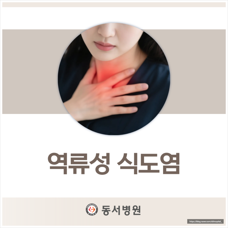 역류성 식도염이 현대인에게 증가하고 있는 이유는 무엇일까요?