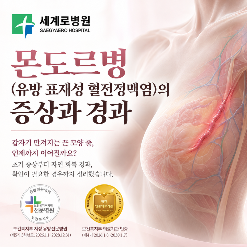 몬도르병(유방 표재성 혈전정맥염)의 증상과 경과