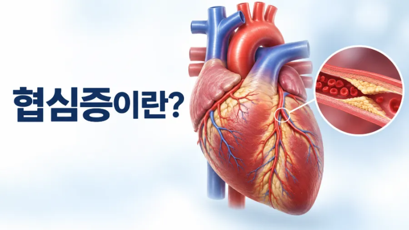 다시 한번 생각하자!협심증이란?