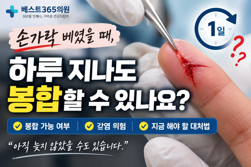 손가락 베였을 때, 하루 지나도 봉합할 수 있나요?