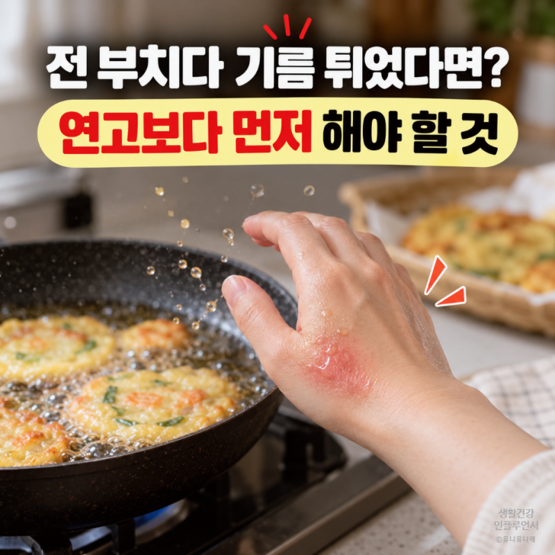 전 부치다 기름 튀어 화상 입었다면? 기름화상 응급처치, 연고, 물집 대처법